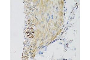 Immunohistochemistry of paraffin-embedded Mouse stomach using DGUOK Polyclonal Antibody at dilution of 1:100 (40x lens). (Deoxyguanosine Kinase antibody)