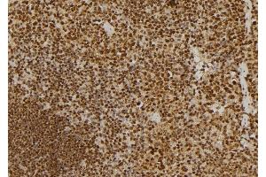 ABIN6275314 at 1/100 staining Mouse spleen tissue by IHC-P. (NUMA1 antibody  (N-Term))