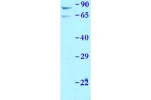 Sample Type: Mouse liverPrimary Dilution: 1:1000 (PRKAA1 antibody  (N-Term))