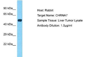 Host: Rabbit Target Name: CHRNA7 Sample Type: Liver Tumor lysates Antibody Dilution: 1. (CHRNA7 antibody  (C-Term))