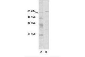 Image no. 1 for anti-Zinc Finger Protein 192 (ZNF192) (N-Term) antibody (ABIN6736101) (ZNF192 antibody  (N-Term))