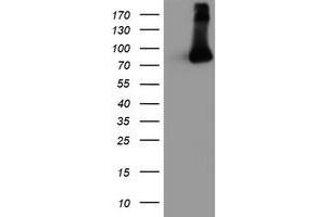 Western Blotting (WB) image for anti-F-Box Protein 21 (FBXO21) antibody (ABIN1498234) (FBXO21 antibody)