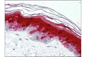 Immunohistochemistry (IHC) image for anti-S100 Calcium Binding Protein A7 (S100A7) antibody (ABIN400722) (S100A7 antibody)