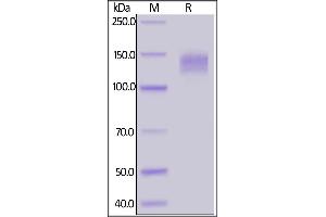 Rabbit LDL R, Fc Tag on  under reducing (R) condition. (LDLR Protein (AA 9-765) (Fc Tag))