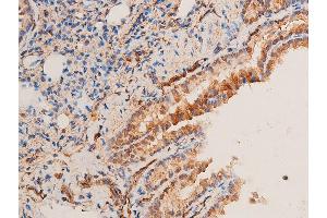 ABIN6256251 and ABIN6267221 at 1/100 staining rat lung tissue sections by IHC-P.
