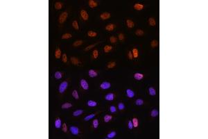 Immunofluorescence analysis of U2OS cells using CSTF2T Rabbit pAb (ABIN6131580, ABIN6139164, ABIN6139165 and ABIN6220675) at dilution of 1:100. (CSTF2T antibody  (AA 420-560))