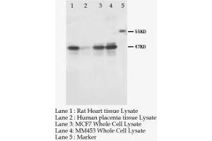 Image no. 1 for anti-Potassium Intermediate/small Conductance Calcium-Activated Channel, Subfamily N, Member 4 (KCNN4) (AA 11-28) antibody (ABIN1495415)