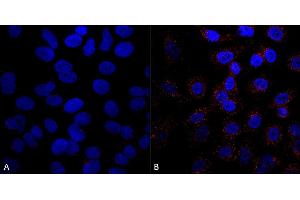 Immunocytochemistry/Immunofluorescence analysis using Mouse Anti-VPS35 Monoclonal Antibody, Clone 5A9 (ABIN6932932). (VPS35 antibody)