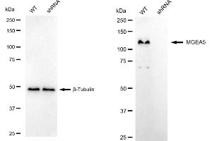 Western blotting analysis using MGEA5 antibody (ABIN7799372). (Recombinant MGEA5 antibody)