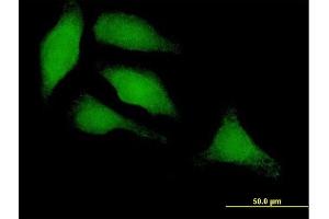 Immunofluorescence of purified MaxPab antibody to IRF3 on HeLa cell. (IRF3 antibody  (AA 1-427))