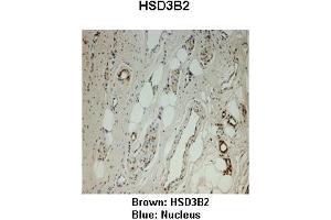 Sample Type :  Monkey vagina   Primary Antibody Dilution :   1:25   Secondary Antibody:  Anti-rabbit-HRP   Secondary Antibody Dilution:   1:1000   Color/Signal Descriptions:  Brown: HSD3B2 Blue: Nucleus   Gene Name:  HSD3B2   Submitted by:  Jonathan Bertin, Endoceutics Inc. (HSD3B2 antibody  (N-Term))