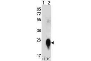 Western blot analysis of CLEC3B (arrow) using rabbit polyclonal CLEC3B Antibody (Center) . (CLEC3B antibody  (Middle Region))