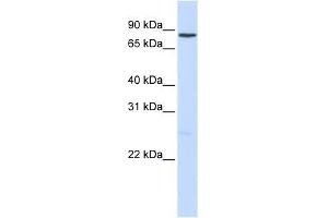 NOTCH1 antibody used at 2. (Notch1 antibody  (Middle Region))