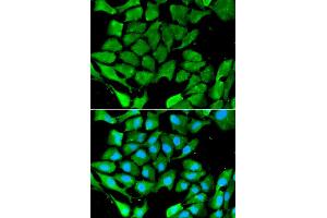 Immunofluorescence analysis of A549 cell using PPARG antibody. (PPARG antibody)