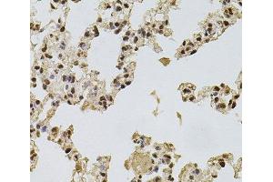 Immunohistochemistry of paraffin-embedded Rat lung using FGF2 Polyclonal Antibody at dilution of 1:100 (40x lens). (FGF2 antibody)