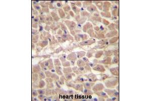 TRIM11 Antibody (C-term) (ABIN657207 and ABIN2846320) immunohistochemistry analysis in formalin fixed and paraffin embedded human heart tissue followed by peroxidase conjugation of the secondary antibody and DAB staining. (TRIM11 antibody  (C-Term))