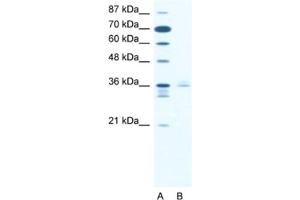 Western Blotting (WB) image for anti-LIM Homeobox 3 (LHX3) antibody (ABIN2460468) (LHX3 antibody)