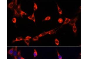 Immunofluorescence analysis of NIH/3T3 cells using CHAT Polyclonal Antibody at dilution of 1:100. (Choline Acetyltransferase antibody)