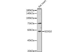Western blot analysis of extracts of Rat heart, using SOX10 antibody (ABIN6134484, ABIN6148289 and ABIN7101829) at 1:1000 dilution. (SOX10 antibody)