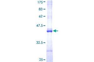 NR1I2 Protein (AA 279-378) (GST tag)