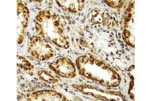 Immunohistochemistry of paraffin-embedded Human kidney using SMAD9 Polyclonal Antibody at dilution of 1:100 (40x lens). (SMAD9 antibody)