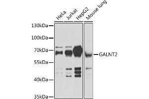 Western blot analysis of extracts of various cell lines, using G antibody (ABIN6133219, ABIN6140940, ABIN6140941 and ABIN6222644) at 1:1000 dilution. (GALNT2 antibody  (AA 442-571))