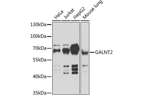 GALNT2 抗体  (AA 442-571)