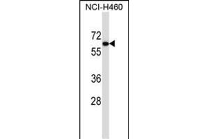 UGT2B11 Antibody (C-term) (ABIN657441 and ABIN2846471) western blot analysis in NCI- cell line lysates (35 μg/lane). (UGT2B11 antibody  (C-Term))