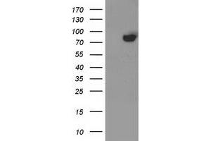 HEK293T cells were transfected with the pCMV6-ENTRY control (Left lane) or pCMV6-ENTRY ACSS2 (Right lane) cDNA for 48 hrs and lysed. (ACSS2 antibody)