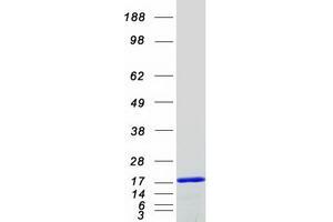 Polymerase (RNA) II (DNA Directed) Polypeptide J, 13.3kDa (POLR2J) protein (Myc-DYKDDDDK Tag)