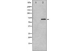 Western blot analysis of PKCB phosphorylation expression in heatshock treated HeLa whole cell lysates,The lane on the left is treated with the antigen-specific peptide. (PKC beta antibody  (pSer661))
