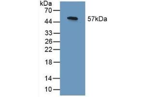 Detection of Recombinant SHC3, Human using Polyclonal Antibody to SHC-Transforming Protein 3 (SHC3) (SHC3 antibody  (AA 188-433))