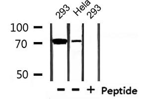 Western blot analysis of extracts from 293 and Hela , using MAP3K3 Antibody. (MAP3K3 antibody)
