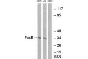 Western Blotting (WB) image for anti-FBJ Murine Osteosarcoma Viral Oncogene Homolog B (FOSB) (AA 12-61) antibody (ABIN2888837) (FOSB antibody  (AA 12-61))