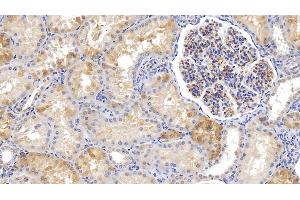 Detection of FTH in Human Kidney Tissue using Monoclonal Antibody to Ferritin, Heavy Polypeptide (FTH) (FTH1 antibody  (AA 1-183))