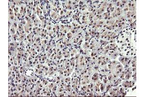 Image no. 1 for anti-HRas proto-oncogene, GTPase (HRAS) antibody (ABIN1498716)
