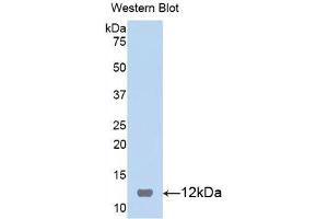 Western blot analysis of the recombinant protein. (S100B antibody  (AA 1-92))