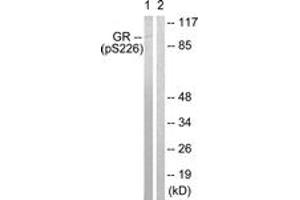 Western blot analysis of extracts from Jurkat cells treated with EGF 200ng/ml 15', using GR (Phospho-Ser226) Antibody. (GR (AA 201-250), (pSer226) antibody)