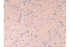 IHC-P analysis of Human Brain Tissue, with DAB staining. (POR antibody  (AA 77-518))