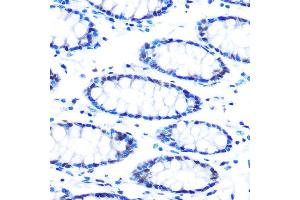 Immunohistochemistry of paraffin-embedded human colon using mSin3A Rabbit mAb (ABIN7270318) at dilution of 1:100 (40x lens).