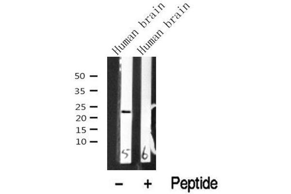 NACA antibody  (N-Term)