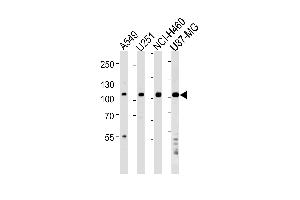 Western blot analysis of lysates from A549,,NCI-,U87-MG cell line (from left to right),using ZNF41 Antibody (N-term) (ABIN1538965 and ABIN2849171). (ZNF41 antibody  (N-Term))