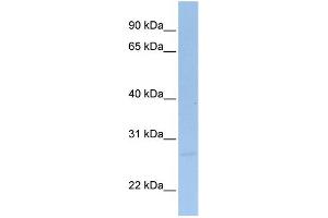 WB Suggested Anti-SIGIRR Antibody Titration:  0. (SIGIRR antibody  (C-Term))