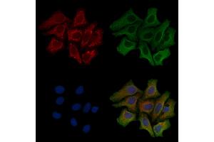 ABIN6258154 and ABIN6275445 staining Hela cells by IF/ICC.