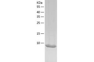 Western Blotting (WB) image for Caspase Recruitment Domain-Containing Protein 18 (ICEBERG) (CARD18) (AA 1-90) protein (His tag) (ABIN7286568) (CARD18 Protein (AA 1-90) (His tag))