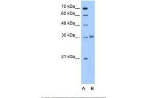 Image no. 1 for anti-Aldolase C, Fructose-Bisphosphate (ALDOC) (N-Term) antibody (ABIN6738437) (ALDOC antibody  (N-Term))
