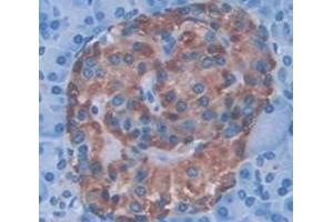 IHC-P analysis of Human Tissue, with DAB staining. (CDK16 antibody  (AA 165-446))