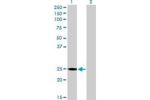 Western Blot analysis of RALB expression in transfected 293T cell line by RALB MaxPab polyclonal antibody.