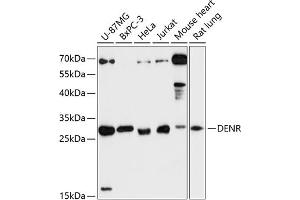 Western blot analysis of extracts of various cell lines, using DENR antibody (ABIN6133498, ABIN6139534, ABIN6139535 and ABIN6217790) at 1:3000 dilution. (Density Regulated Protein antibody  (AA 1-198))