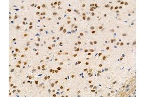 Phospho-ARRB1 (Ser412) Antibody at 1/100 staining Rat brain tissue by IHC-P.